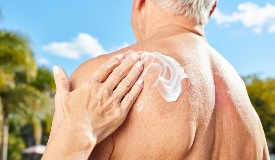 Frau versorgt Mann mit Sonnencreme