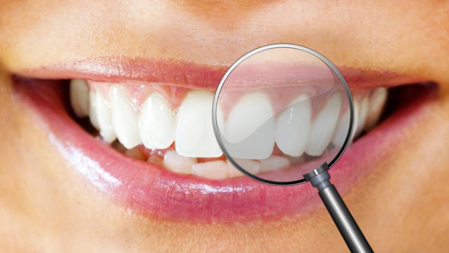 Strahlendes Lächel vom Mund einer Frau mit weißen Zähnen mit Lupe 